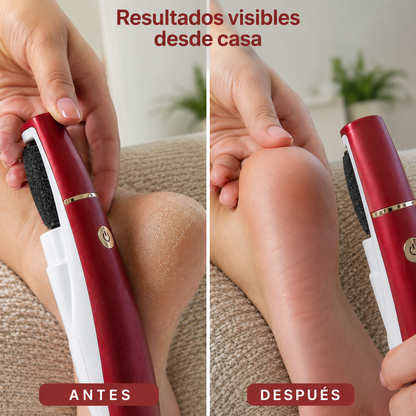PediPro MX